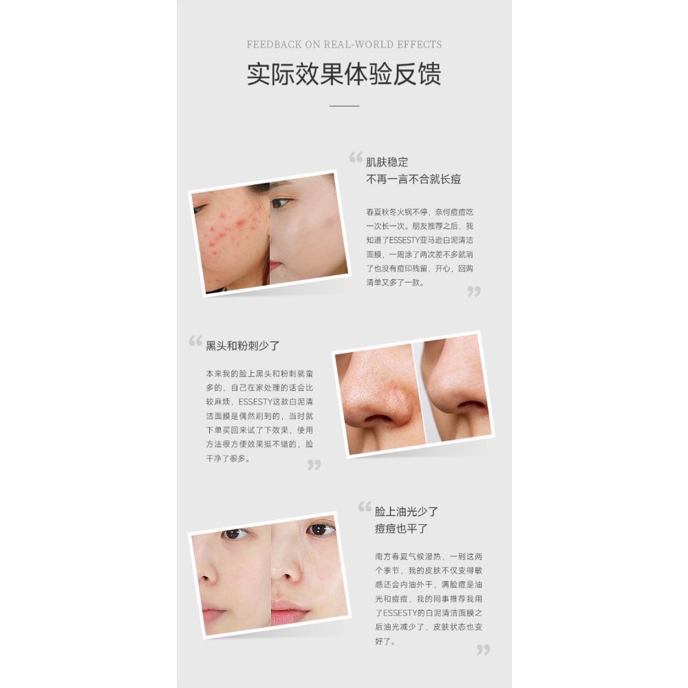 【法國原裝】亞馬遜白泥清潔面膜塗抹泥膜去黑頭125mlEssesty-細節圖8