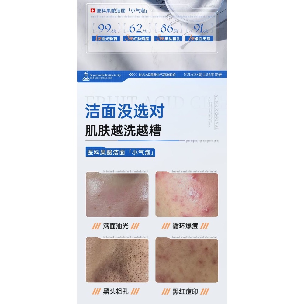 瑞士進口nulad果酸小氣泡洗面奶-細節圖9