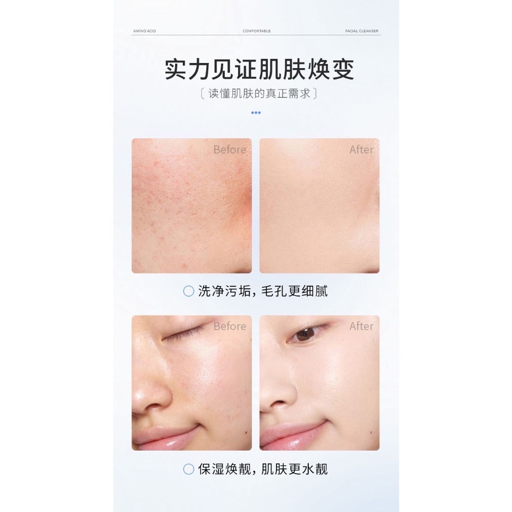 洗顏溫和清潔控油黑頭祛痘潔面乳保濕氨基酸洗面奶-細節圖7
