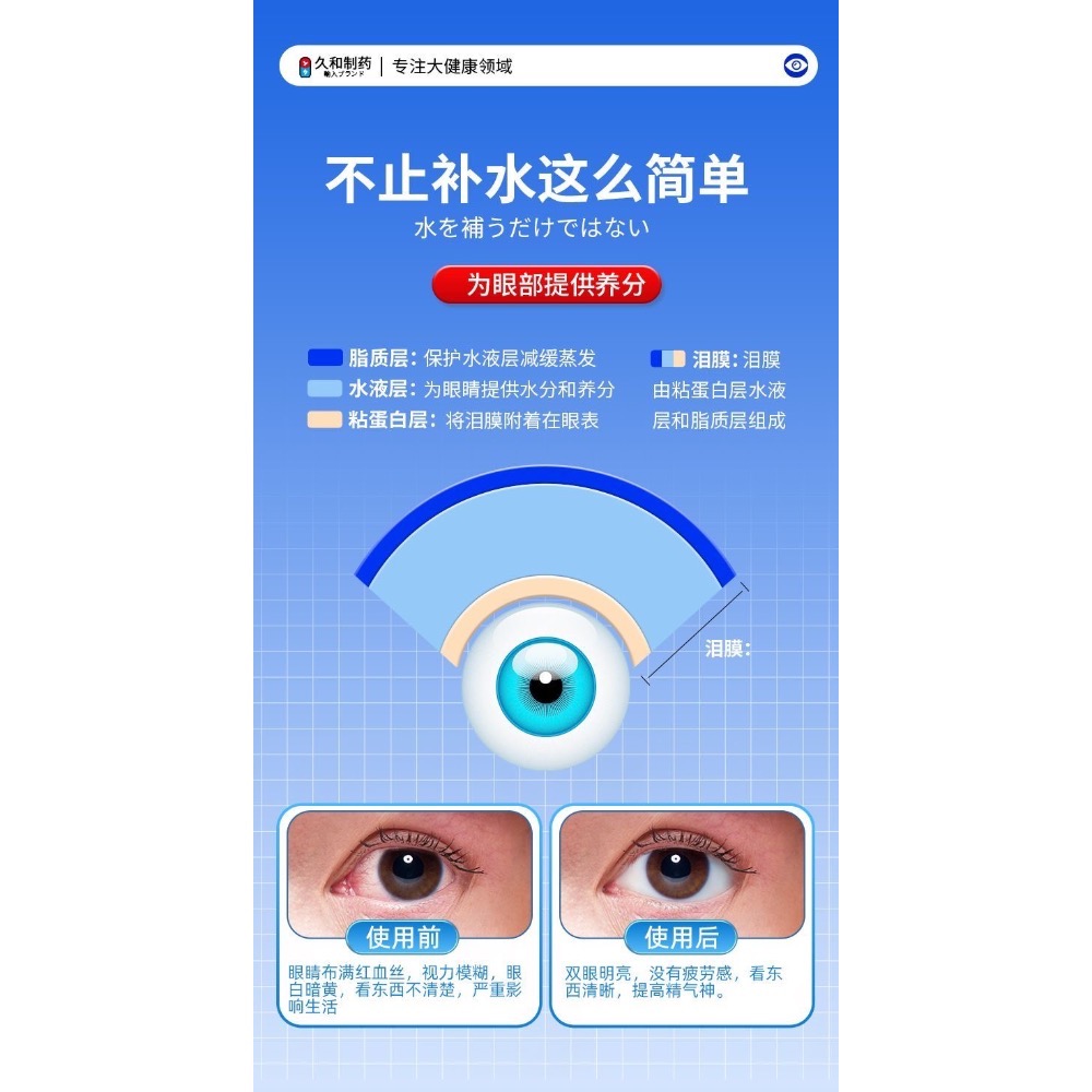 日本FUJIYOKO緩解疲勞乾澀模糊改善視力清涼護眼液3瓶-細節圖9