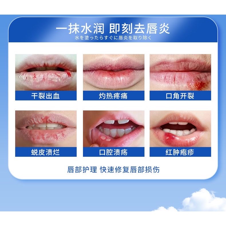 日本久和製藥唇炎修復潤唇膏3入-細節圖2