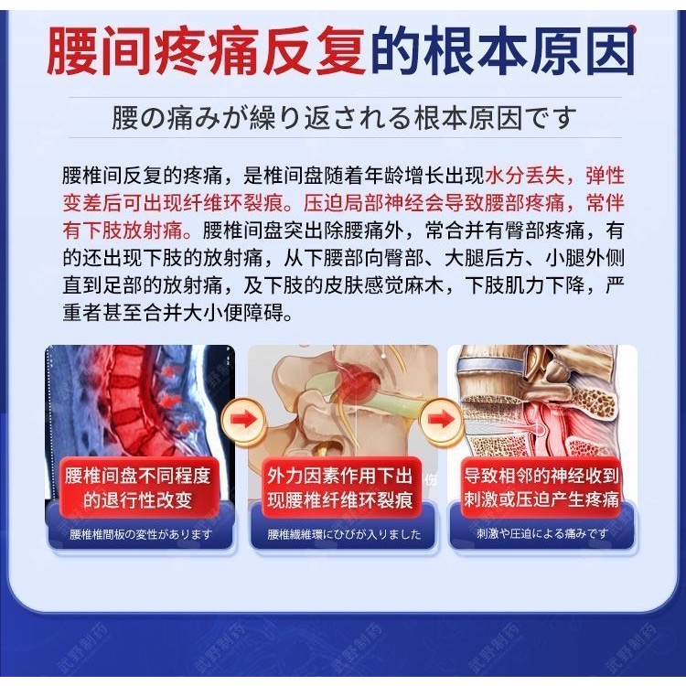 日本久和製藥原裝緩解腰椎壓迫神經腰間盤突出疼痛貼布3盒-細節圖3