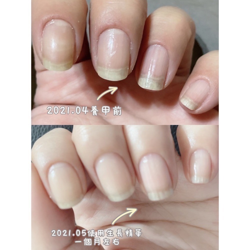 養甲套組優惠活動-細節圖6