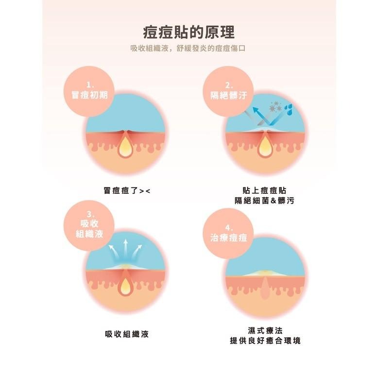 【優若美MaySkin 超隱形痘痘貼】痘貼 痘痘貼 0.01cm超隱形 美國製造 黑頭粉刺 控油 遮瑕 人工皮 醫療級-細節圖4