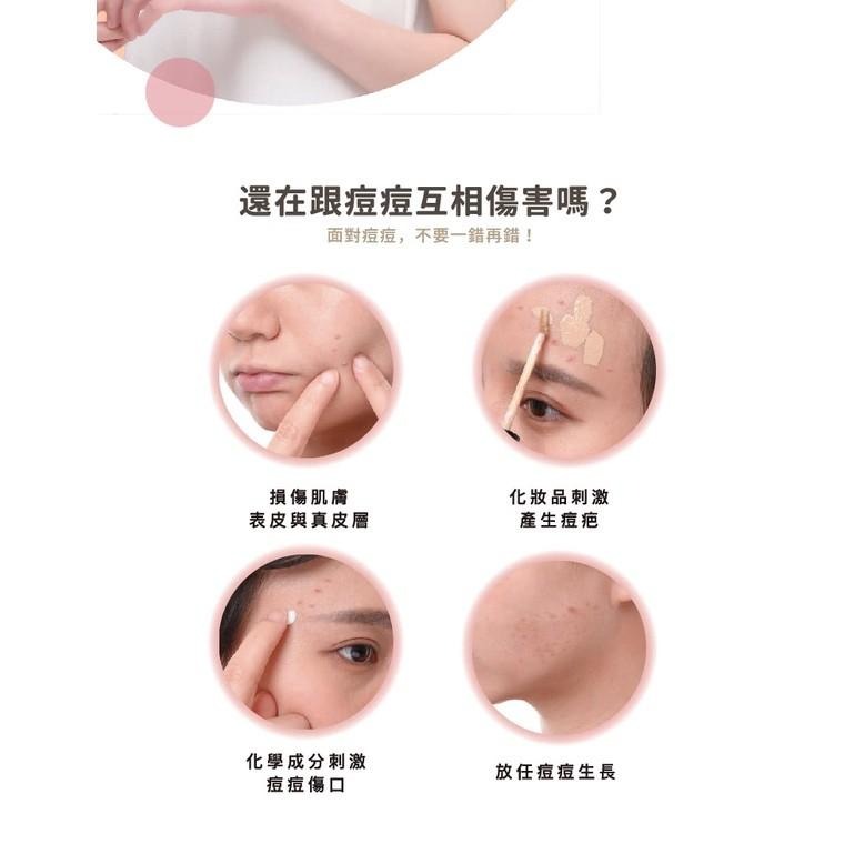 【優若美MaySkin 超隱形痘痘貼】痘貼 痘痘貼 0.01cm超隱形 美國製造 黑頭粉刺 控油 遮瑕 人工皮 醫療級-細節圖7