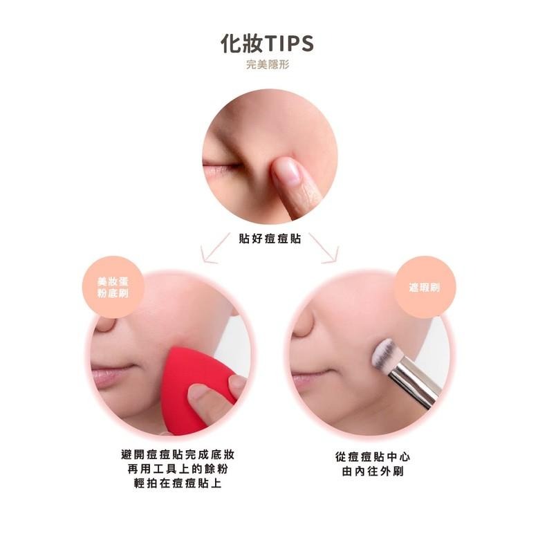 【優若美MaySkin 超隱形痘痘貼】痘貼 痘痘貼 0.01cm超隱形 美國製造 黑頭粉刺 控油 遮瑕 人工皮 醫療級-細節圖9