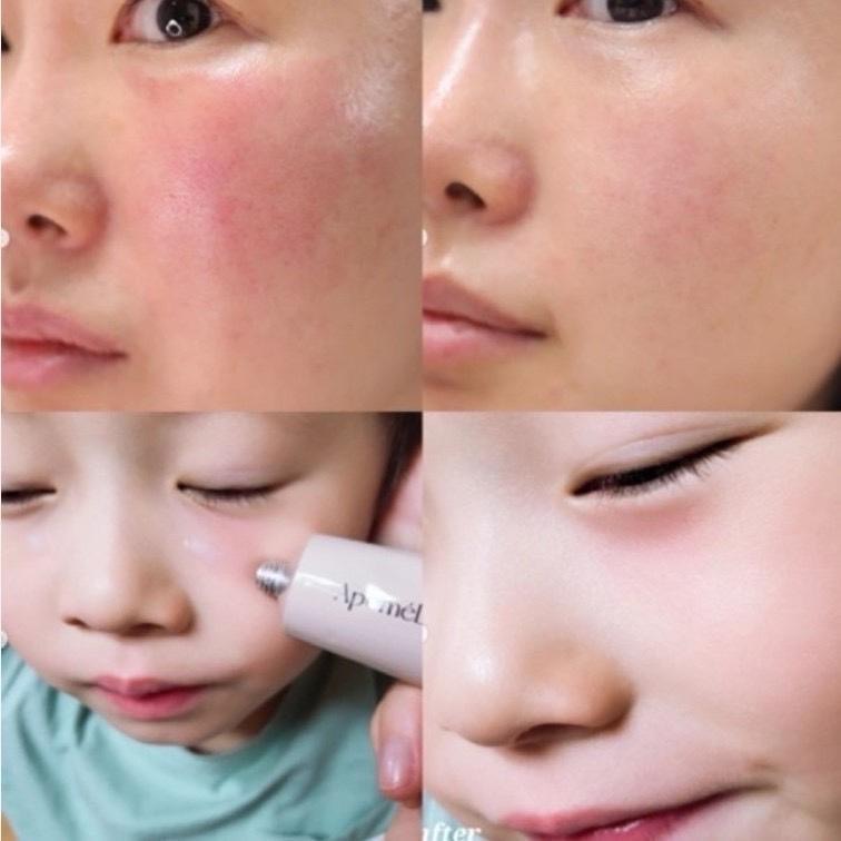 廠商現貨德國藥店品牌ApomeDerm萬用神霜30ML-細節圖3