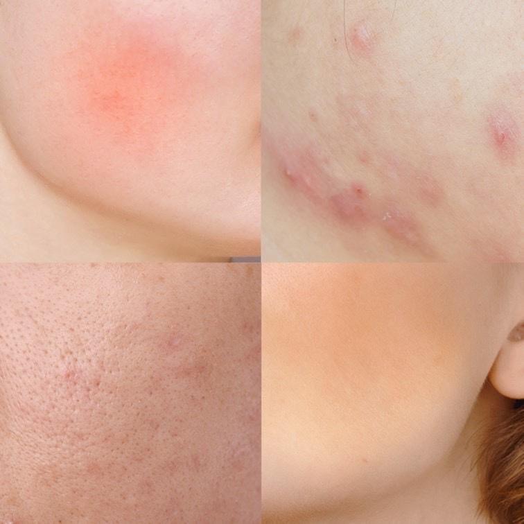 廠商現貨德國藥店品牌ApomeDerm萬用神霜30ML-細節圖5