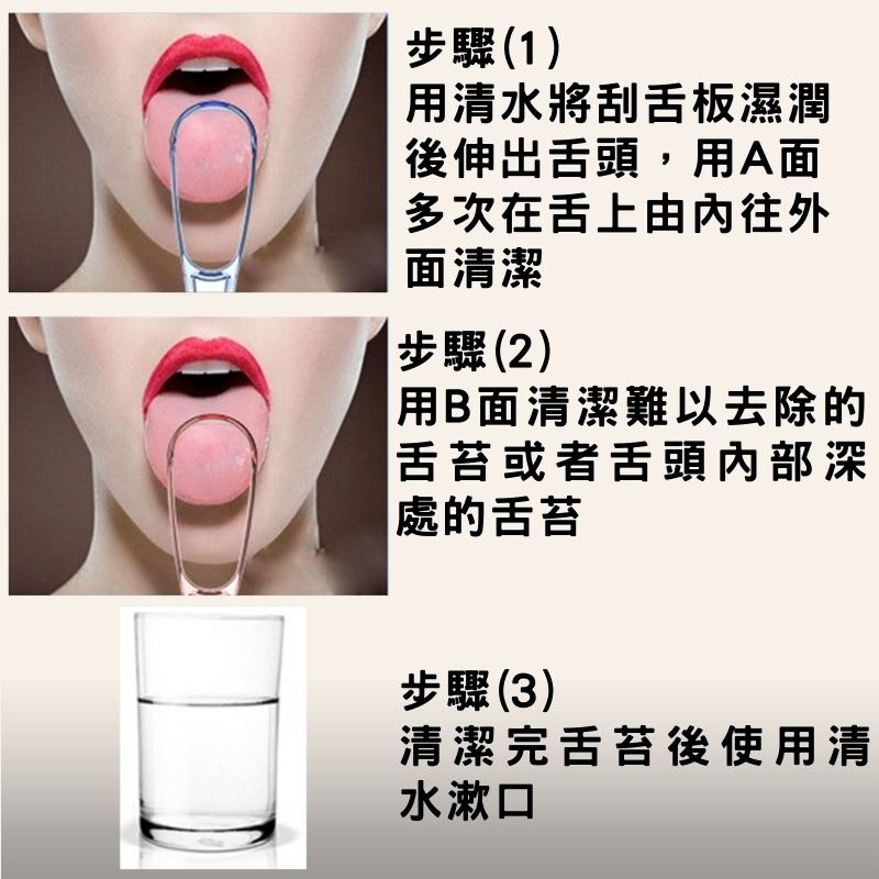 舌苔清潔板 清潔舌苔 袪除異味 口腔清潔好搭檔 (隨機出貨不挑色)-細節圖5