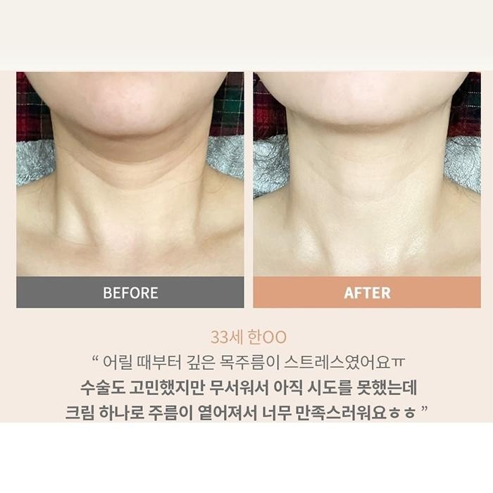 韓國 B PROJECT 滾輪頸霜 100ml 撫紋霜 頸部保養 滾輪按摩 不沾手-PQ美妝-細節圖4