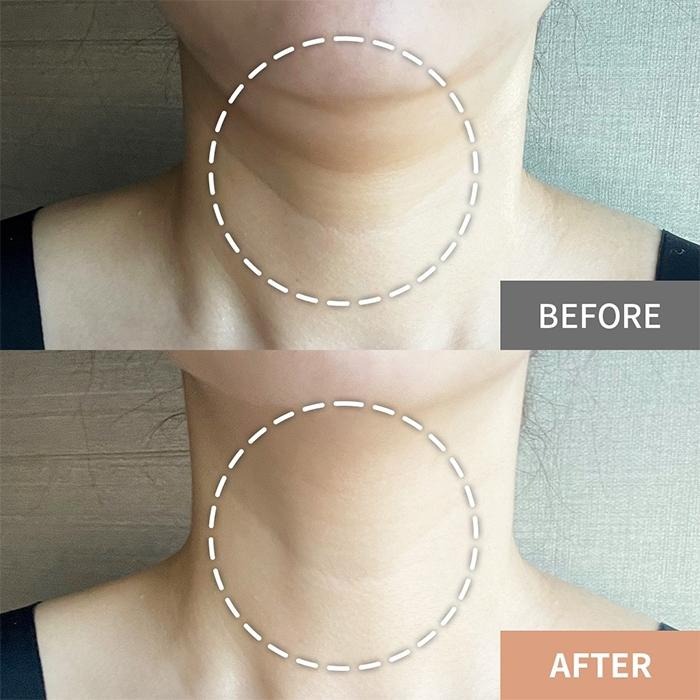 韓國 B PROJECT 滾輪頸霜 100ml 撫紋霜 頸部保養 滾輪按摩 不沾手-PQ美妝-細節圖7