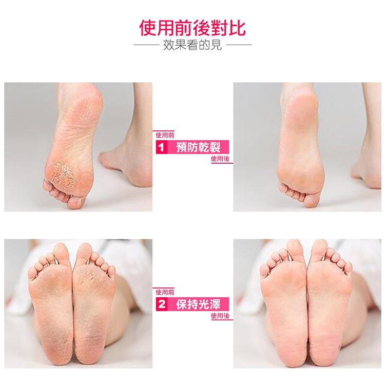 『熊愛貝百貨』矽膠透氣保濕減壓足套-細節圖3