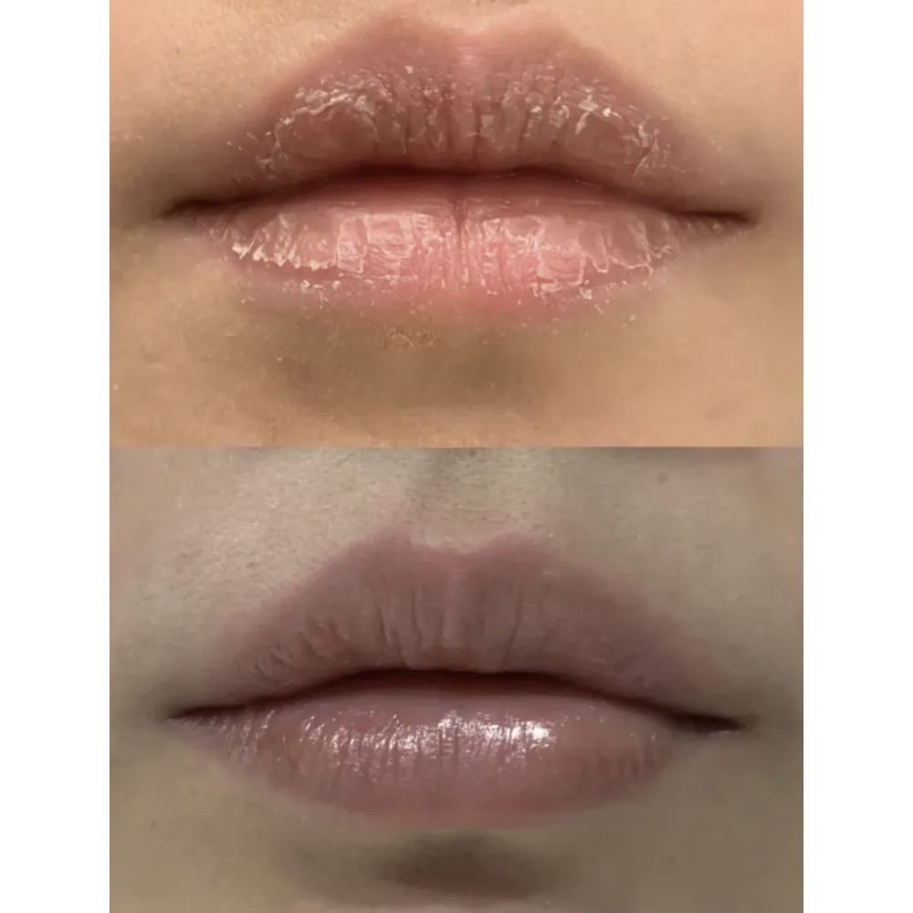 【Malin+Goetz】修護潤唇凝膠10ml (現貨)-細節圖5