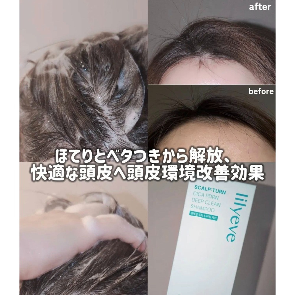 現貨 韓國 lilyeve 積雪草PDRN頭皮深層清潔洗髮精500ml/頭皮舒緩精華 100ml-細節圖5
