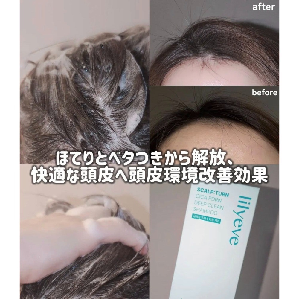 現貨 韓國 lilyeve 積雪草PDRN頭皮深層清潔洗髮精500ml/頭皮舒緩精華 100ml-細節圖5