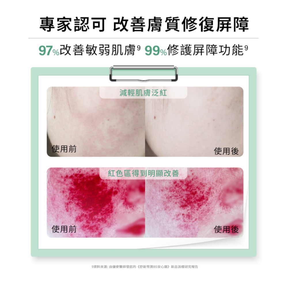 Cetaphil 舒特膚 舒新雪潤B5安心霜-細節圖4