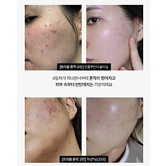 韓國MEDITHERAPY—抗老修護A醛精華150ml-細節圖4