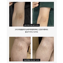 韓國MEDITHERAPY—抗老修護A醛精華150ml-細節圖5