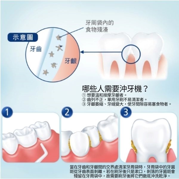 Panasonic 國際牌 無線國際電壓充電式沖牙機 EW-DJ66-細節圖2