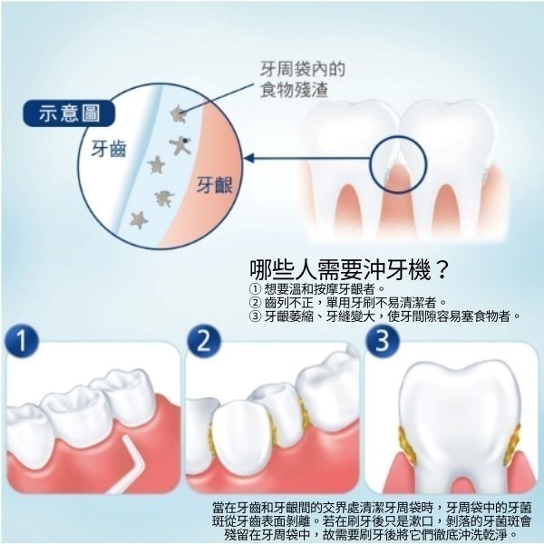 Panasonic 國際牌 無線電國際電壓快速充電沖牙機 EW-DJ86-細節圖2