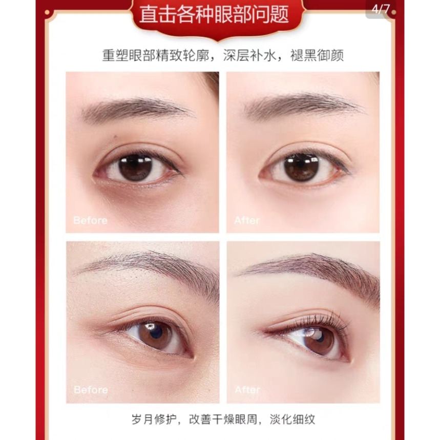 魚子醬電動按摩儀眼霜-細節圖2