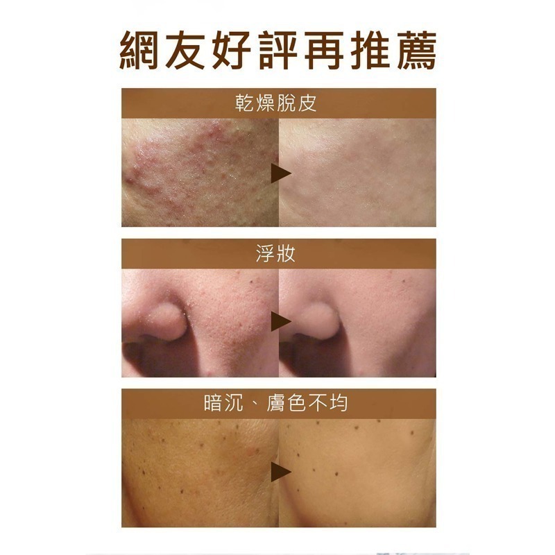 Mdmmd 明洞國際 Upra美白保濕乳 40mL 升級版地漿水 懶人保養 美白 保濕 乳液【官方直營】-細節圖7