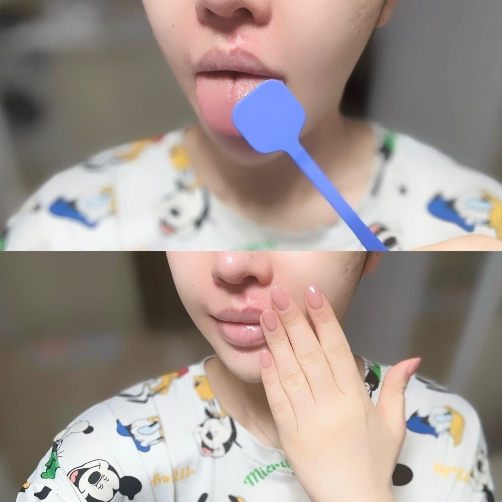 La Dens｜樂旦斯 矽膠舌苔刷 舌苔清潔刷 舌苔刷頭替換組 好口氣 消口臭 口腔清潔｜smnida美妝｜-細節圖4