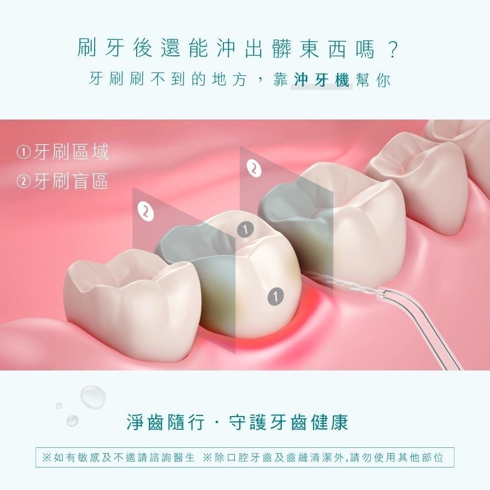 【KINYO】伸縮沖牙機 隨身攜帶型潔牙器 USB充電沖齒機 脈衝洗牙器-細節圖2