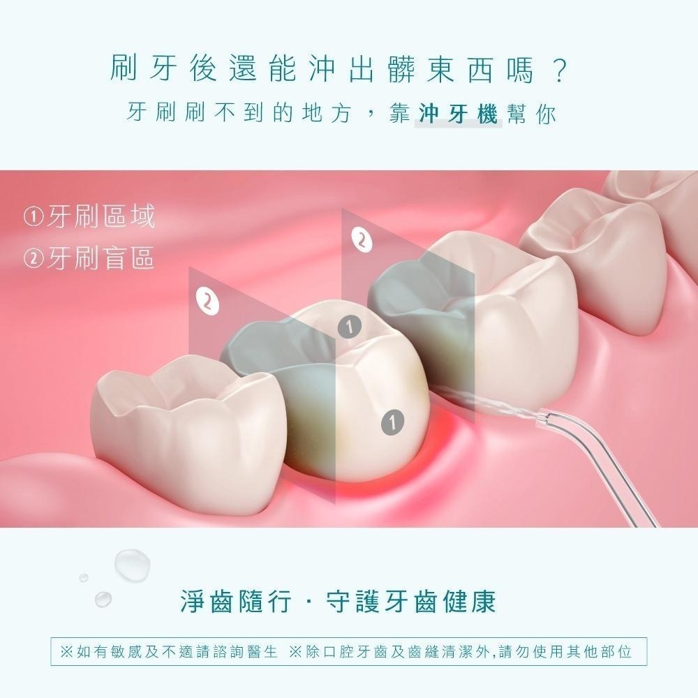 【KINYO】伸縮沖牙機 隨身攜帶型潔牙器 USB充電沖齒機 脈衝洗牙器-細節圖2