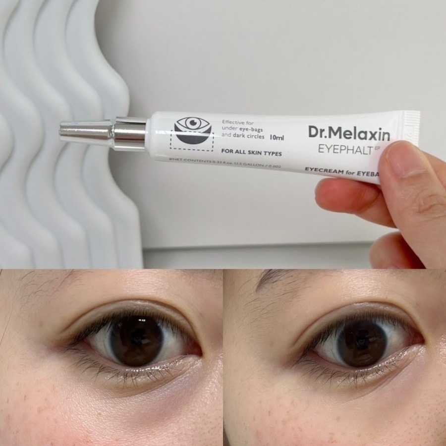 Dr.Melaxin｜眼袋修護眼霜 眼霜 眼部精華 眼部保養 眼袋 極緻修護｜AnniuKr｜-細節圖3