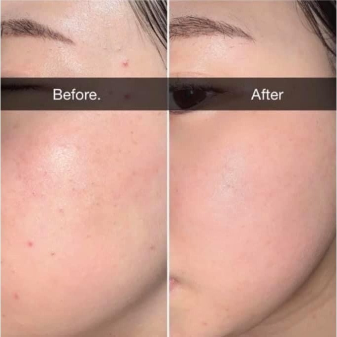 Oganacell｜高濃度胜肽淨透潔面凝膠 龍捲風洗面乳 潔面乳 胜肽 溫和 保濕 深層清潔｜｜AnniuKr｜-細節圖5