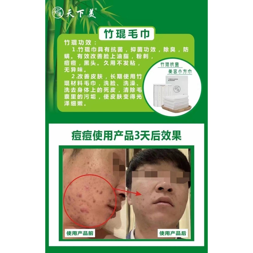 竹琨毛巾-細節圖2