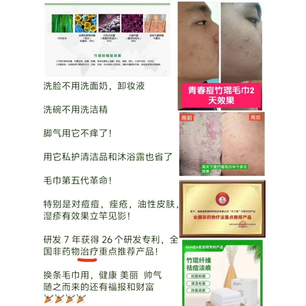 竹琨毛巾-細節圖3