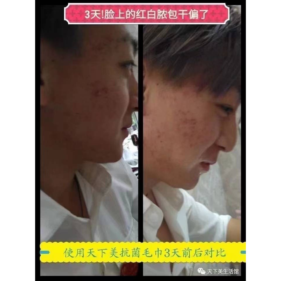 竹琨毛巾-細節圖5