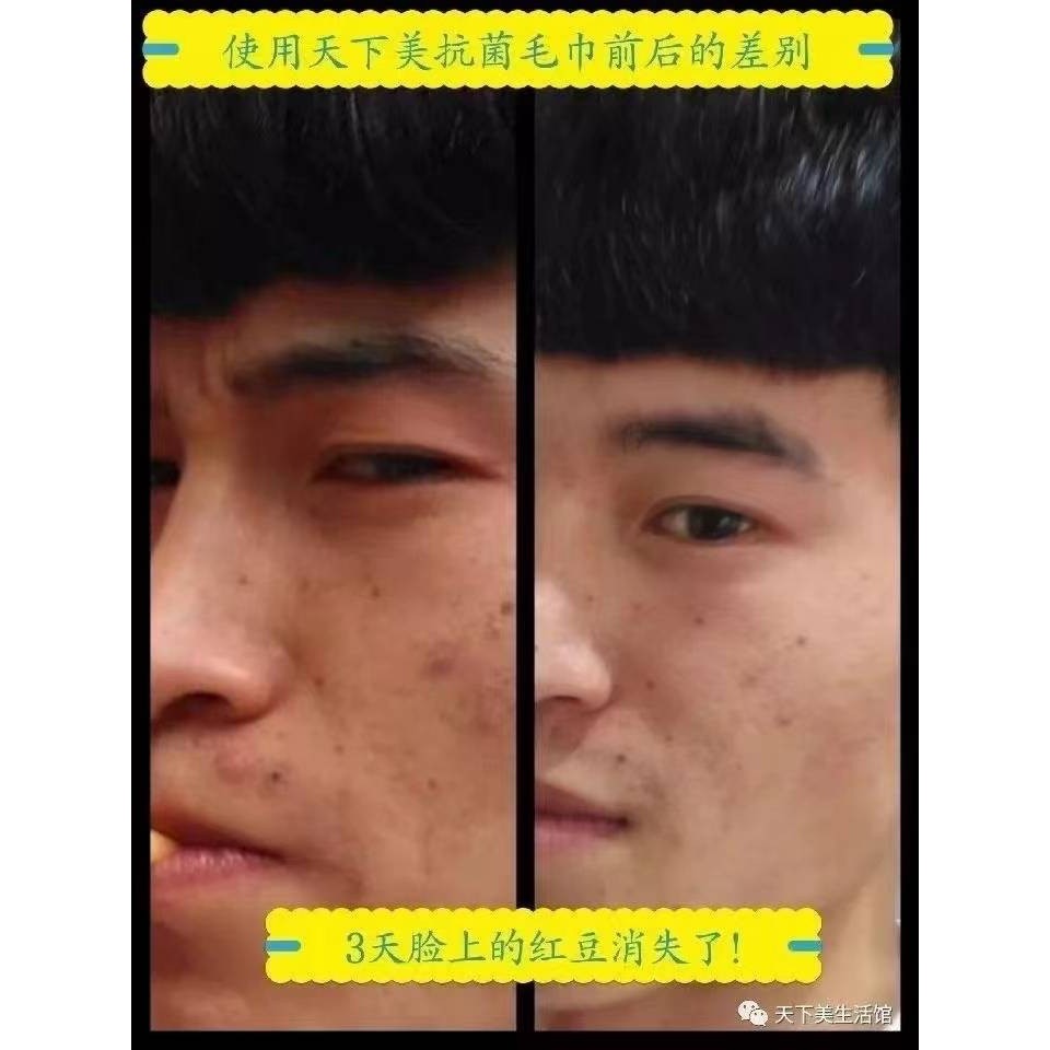 竹琨毛巾-細節圖6