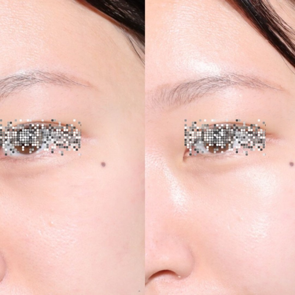 MEDITHERAPY｜白玉冰晶煥白眼頰膜 谷胱甘肽 白番茄萃取 亮白 保濕  玻尿酸 眼頰膜｜DBK生活美學｜-細節圖5