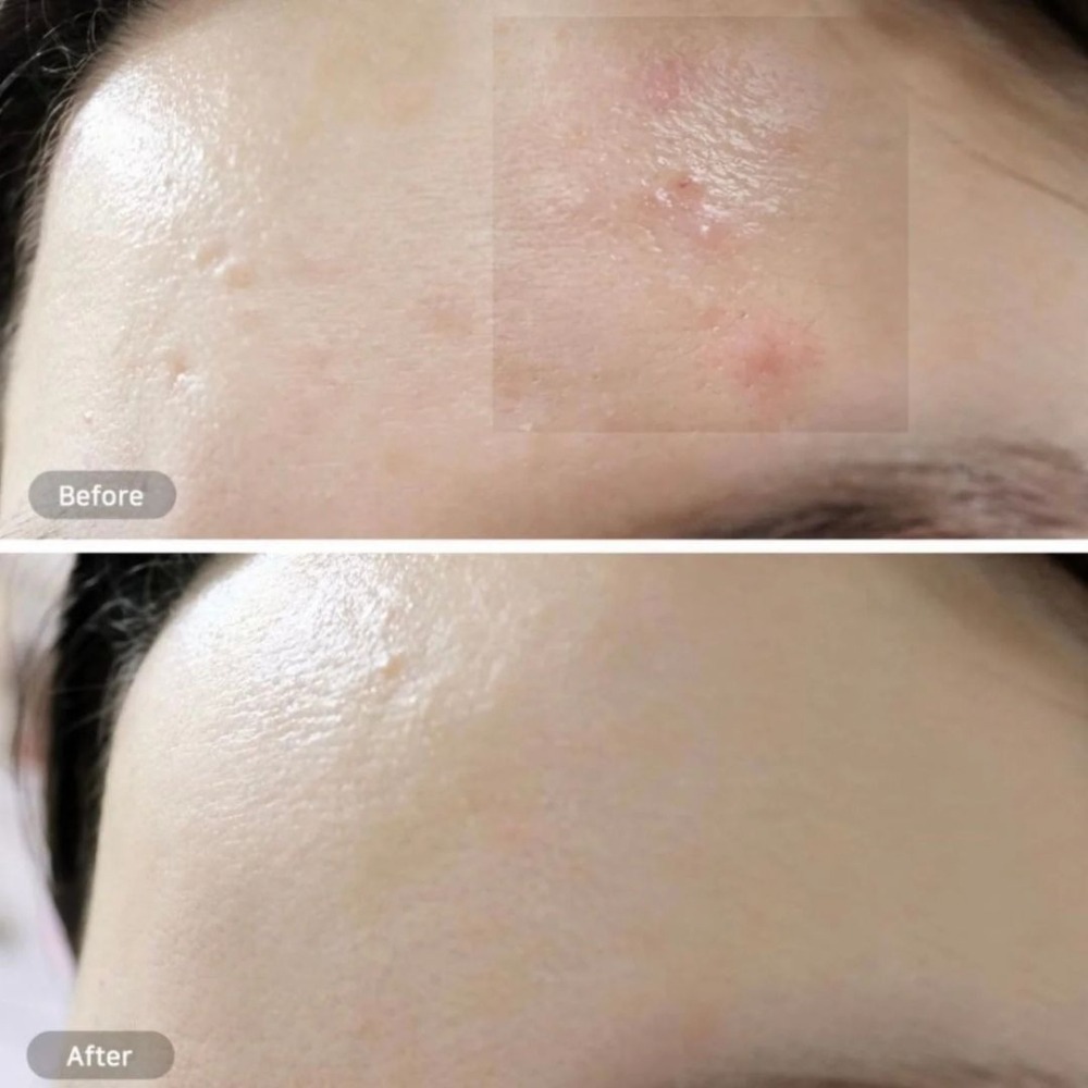 BEPLAIN｜綠豆胺基酸洗面乳 綠豆毛孔清潔泥膜 毛孔淨化 溫和清潔 氨基酸 綠豆酵素｜DBK生活美學｜-細節圖4