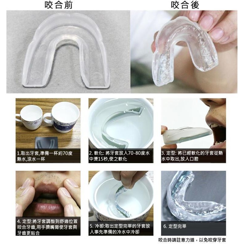 【單面/雙面】可塑型雙面護齒套 防打鼾運動牙套空手道跆拳道護齒牙套單面運動護齒套 籃球拳擊 護牙套 拳擊牙套 防磨牙套-細節圖6