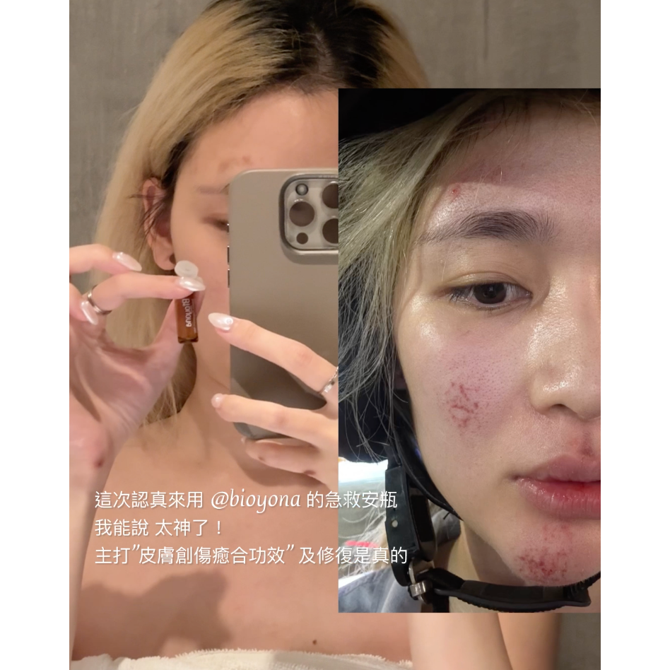 【 醫美級頂級保養 】海洋胚顏 肌活修護精華安瓶-細節圖5