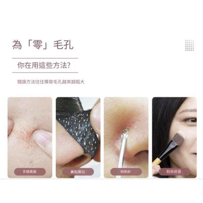 EMS超聲波4模式黑頭鏟提拉儀-細節圖2