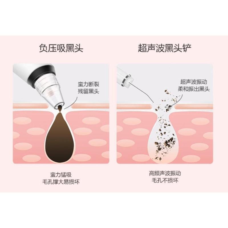 EMS超聲波4模式黑頭鏟提拉儀-細節圖4