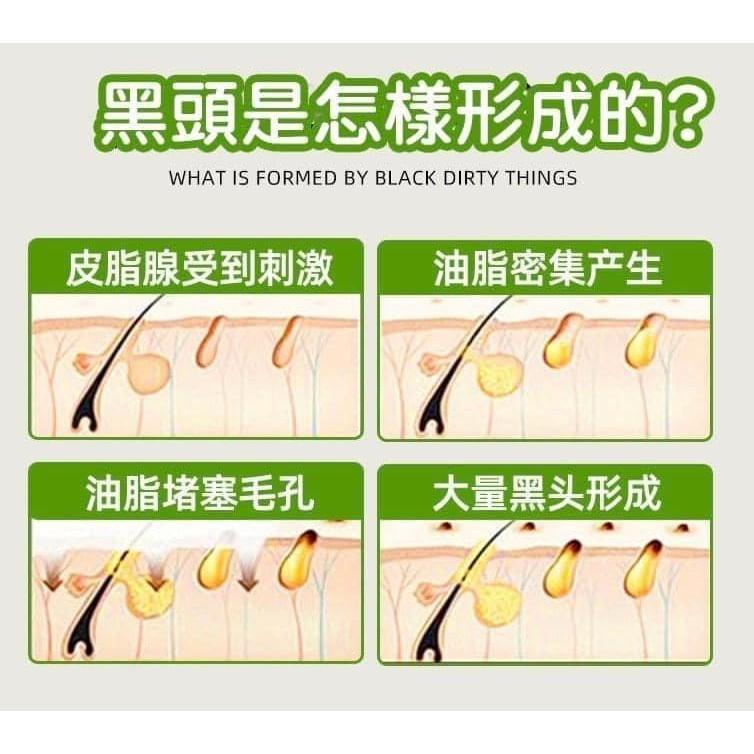 瓶裝竹炭去黑頭粉刺撕拉面膜-細節圖6