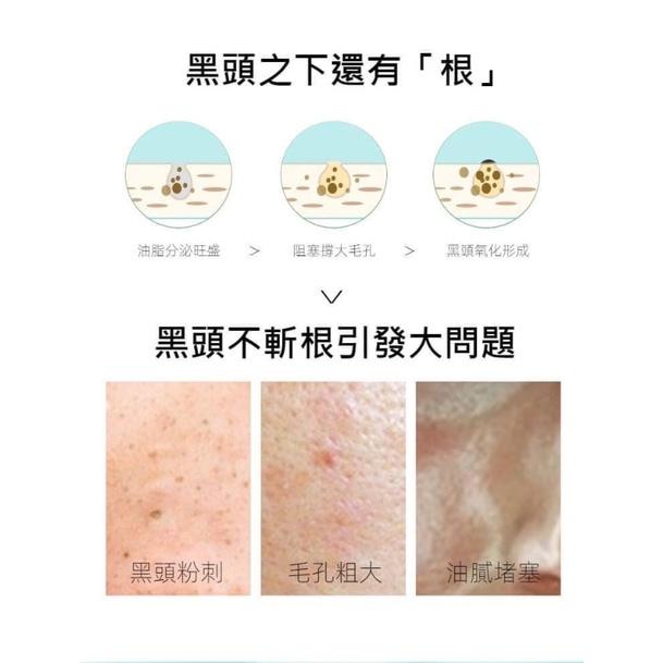 小豬竹炭去黑頭粉刺鼻貼5片裝(一組5包)-細節圖3