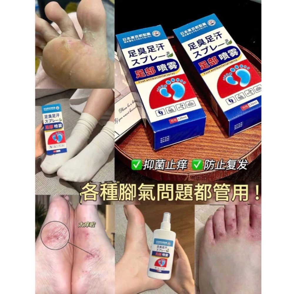 【日本JP止汗抑菌除腳臭腳汗噴霧】-細節圖2