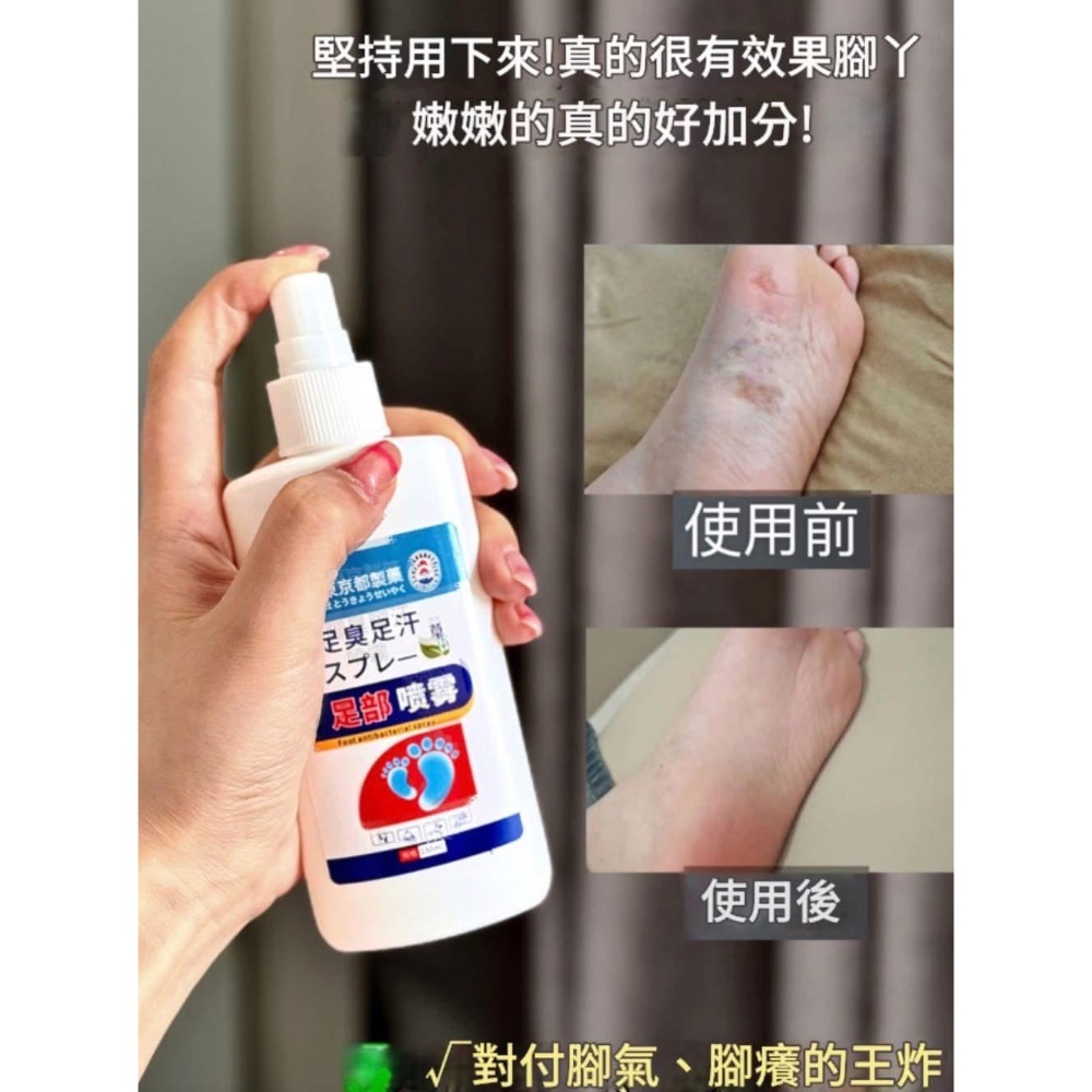 【日本JP止汗抑菌除腳臭腳汗噴霧】-細節圖4