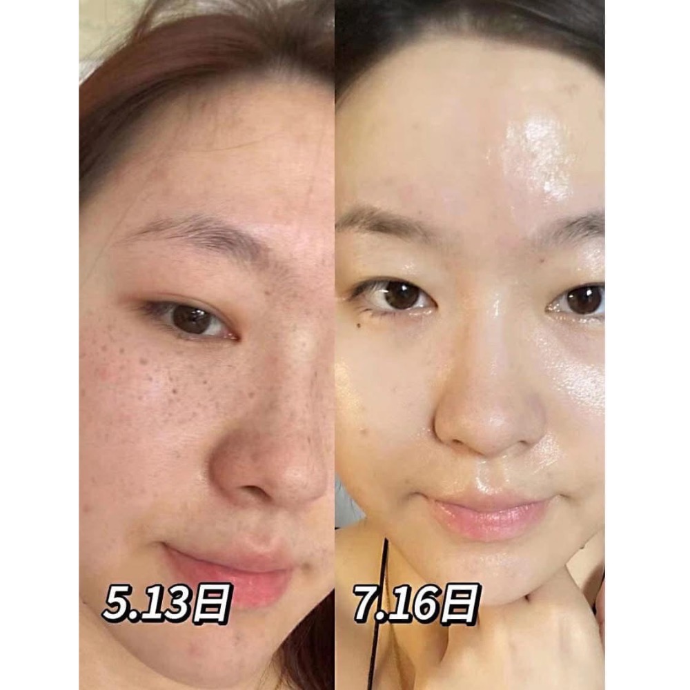 【HAIBINH•泰國祛斑膏（一組2條）】-細節圖9