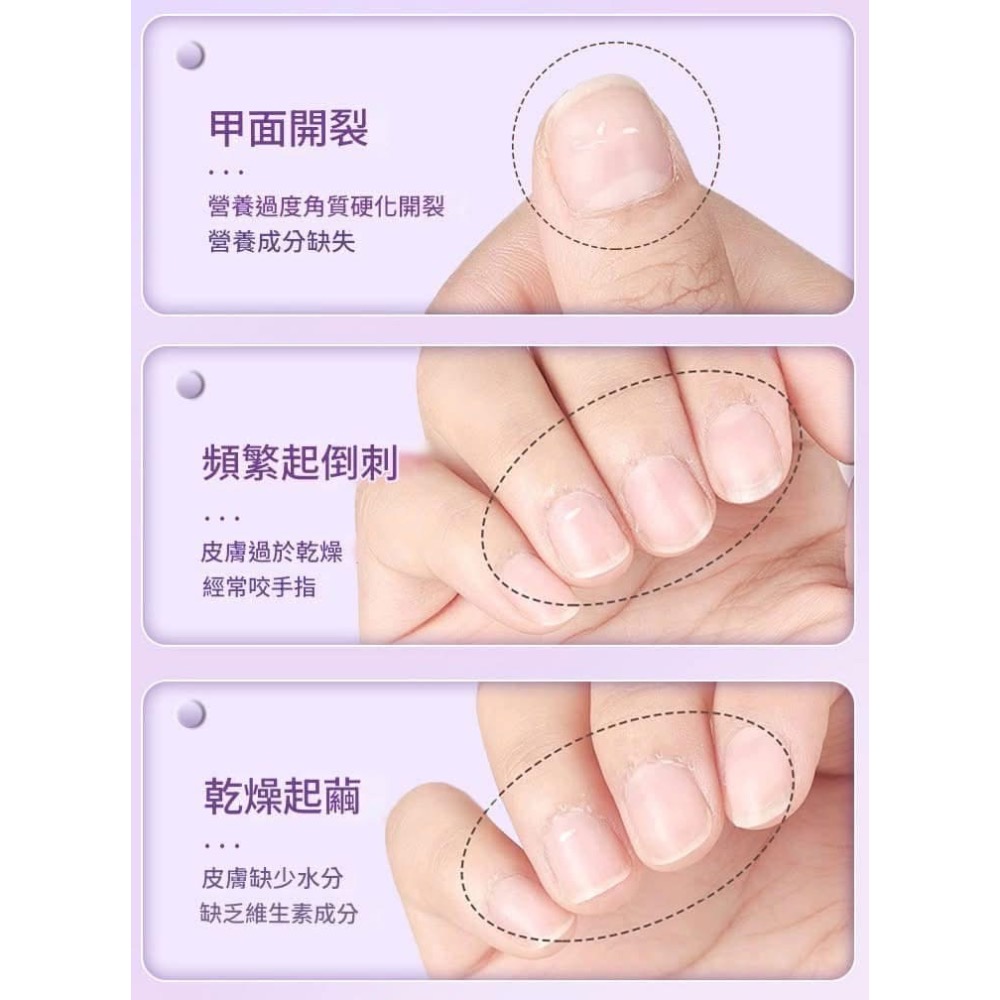 【爆紅3合1護甲精華修護指緣美甲筆(一組2支)】-細節圖9