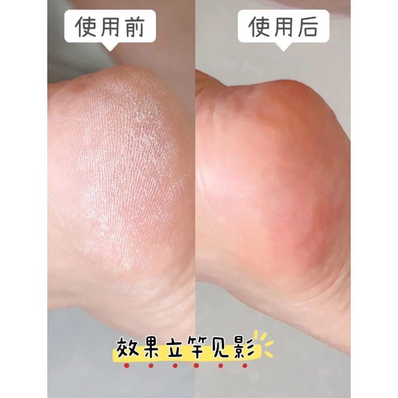 香港SUSIR防蛇油膏-細節圖8