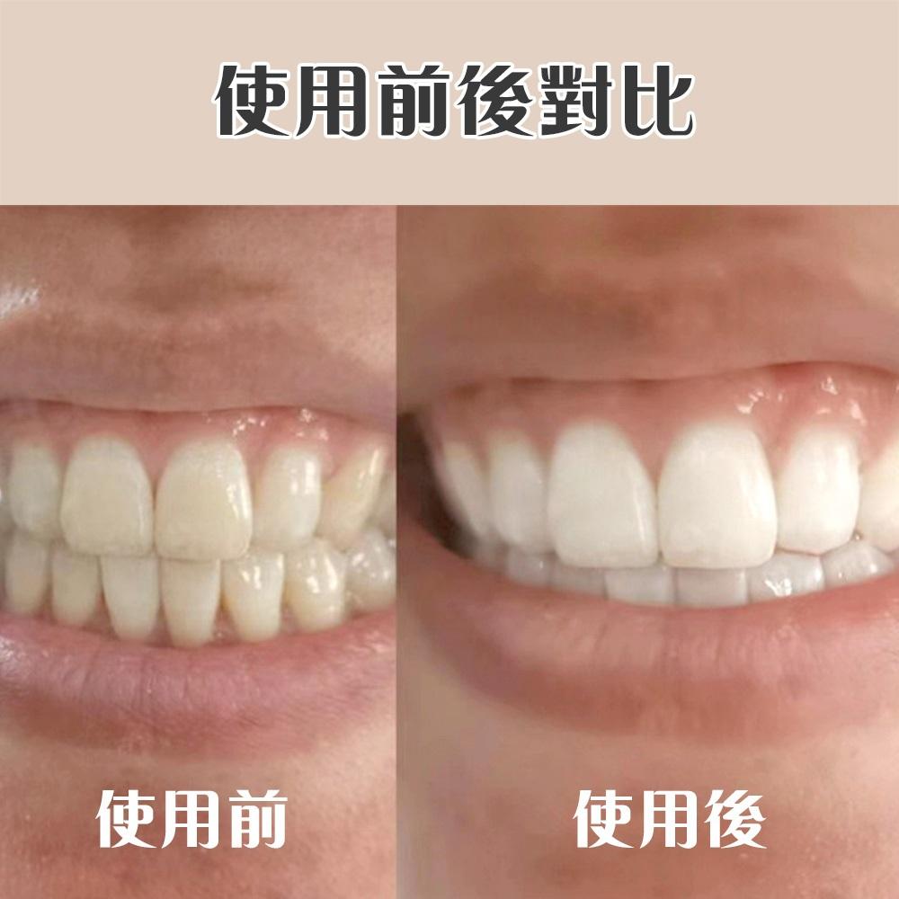 🔥台灣現貨🔥牙齒美白橡皮擦 牙齒清潔 潔牙擦 牙垢清潔棉 牙垢 牙齒橡皮擦 奈米清潔 牙垢去除器 出口日本-細節圖5