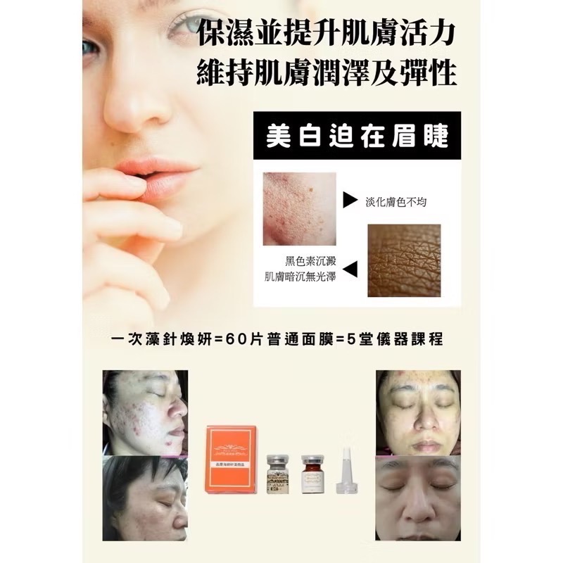 【扉笛絲】店內熱銷款🔥醫美級晶鑽美白抗痘藻針買三送一✅-細節圖3